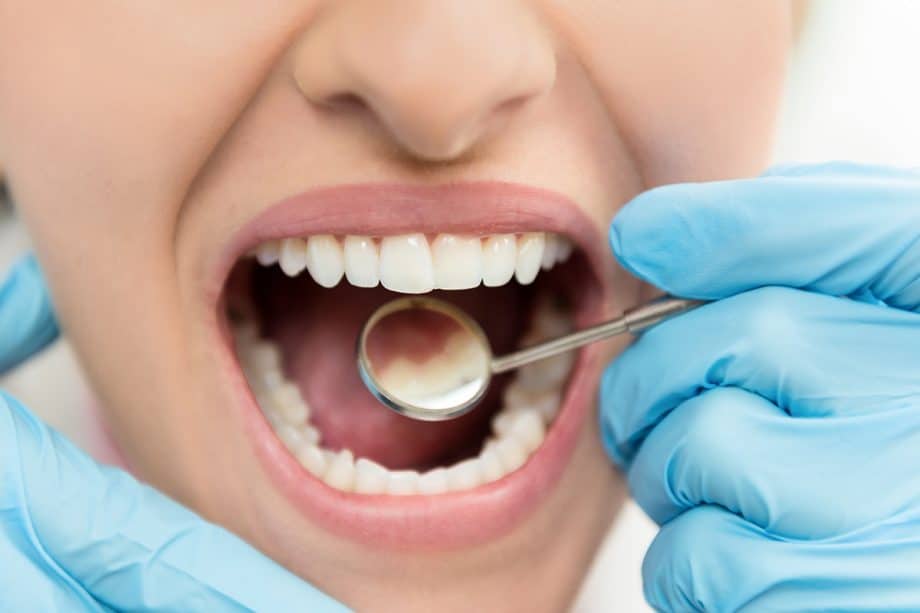 How Long Does A Teeth Cleaning Take?